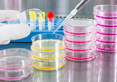 Optimize Exosome Isolation with Ultracentrifugation